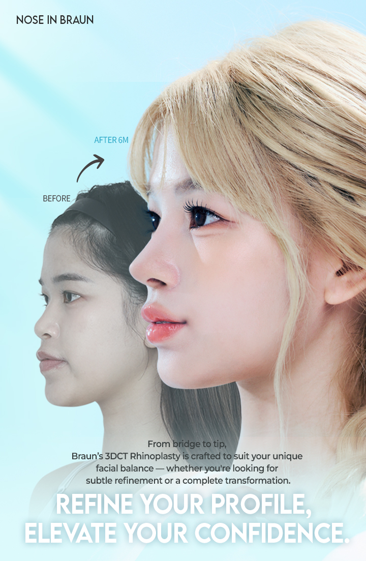 /data/apms/background/BRAUN nose surgery 3DCT before and after results highlighting natural side profile improvement.jpg