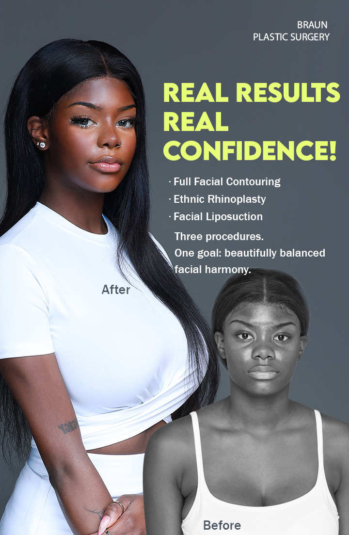 /data/apms/background/BRAUN before and after facial contouring results showing improved facial balance.jpg