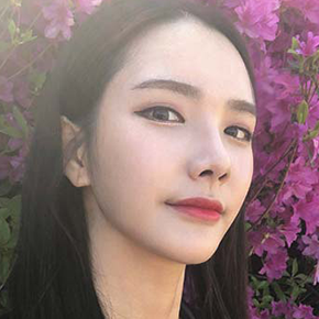 3D CT Rhinoplasty after