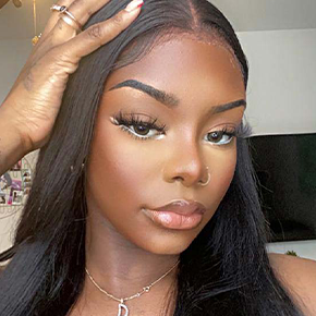 3D CT Rhinoplasty after