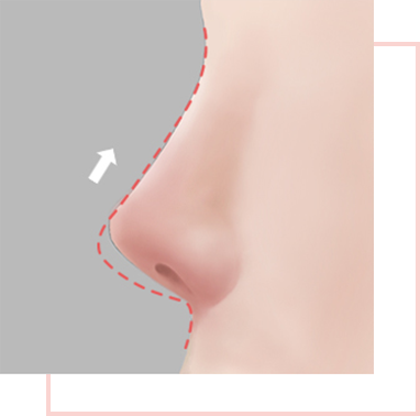 Contracture or inflammation