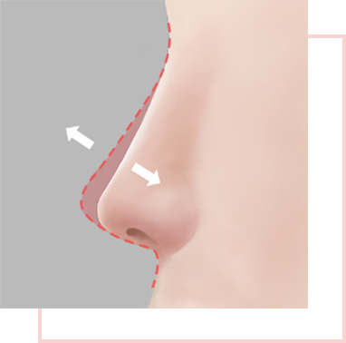 Height of the nose bridge (too high or too low)