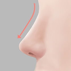 A beautiful nose line is completed