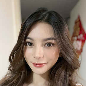 Double Eyelid Surgery after