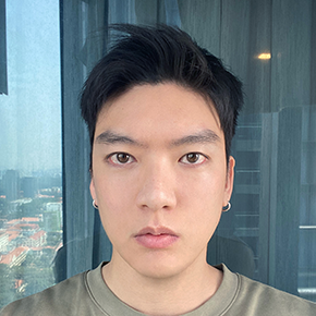 Double Eyelid Surgery after