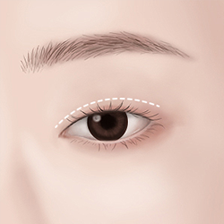 Designing an ideal nose line with balanced height and shape to complement facial proportions