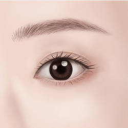 Completing a bright and well-defined eye appearance after eyelid surgery