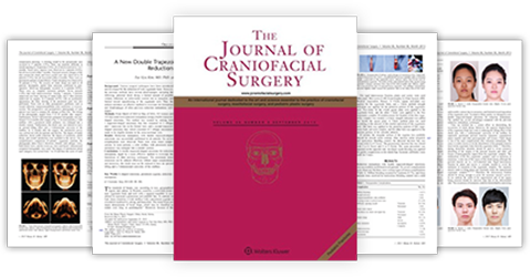 Publishing a research thesis on inverted V-shaped osteotomy in The Journal of Plastic and Reconstructive Surgery
