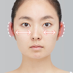 Assessing severe facial asymmetry following surgery during postoperative evaluation