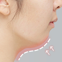 Assessing persistent chin recession following chin surgery during postoperative evaluation