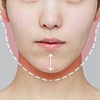 Assessing excessive chin length persisting after chin surgery during postoperative evaluation