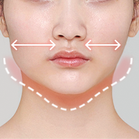 Assessing bumpy or uneven chin and jawline following surgery during postoperative evaluation