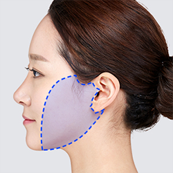 Releasing the retaining ligaments in the targeted area during facelift surgery