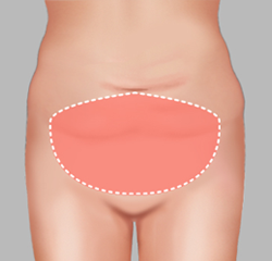 Upper abdomen & Lower Abdomen