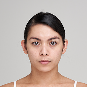 Face Contouring BEFORE