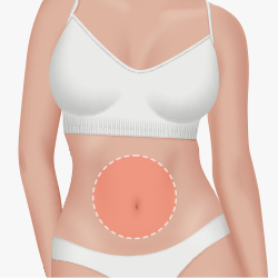 Abdominal liposuction