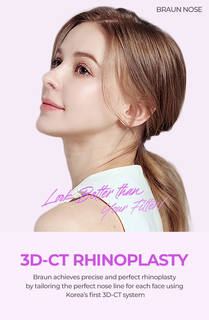 BRAUN 3D-CT rhinoplasty profile image highlighting refined nasal contour