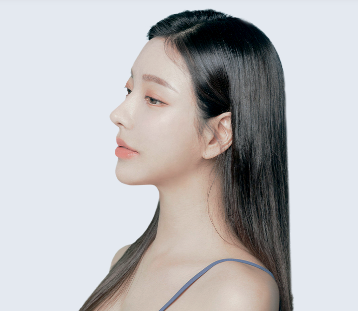 Revision Rhinoplasty