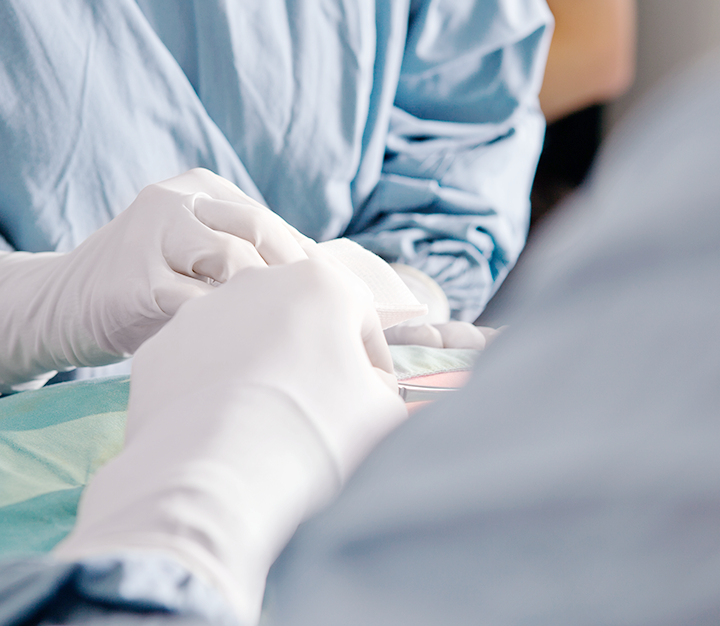 Revision Double Eyelid Surgery