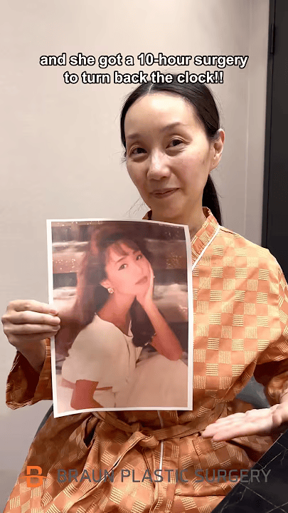 Short-form video thumbnail showing post-procedure patient appearance